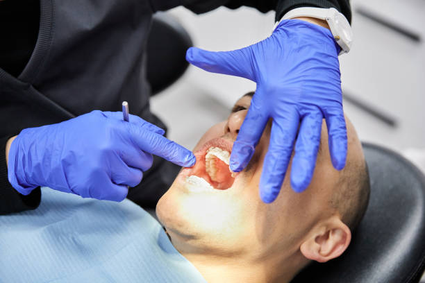 Best Emergency Root Canal Treatment in Rose Hill, VA